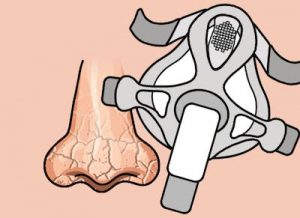 CPAP呼吸機(jī)好(hǎo)處在哪裡(lǐ)?