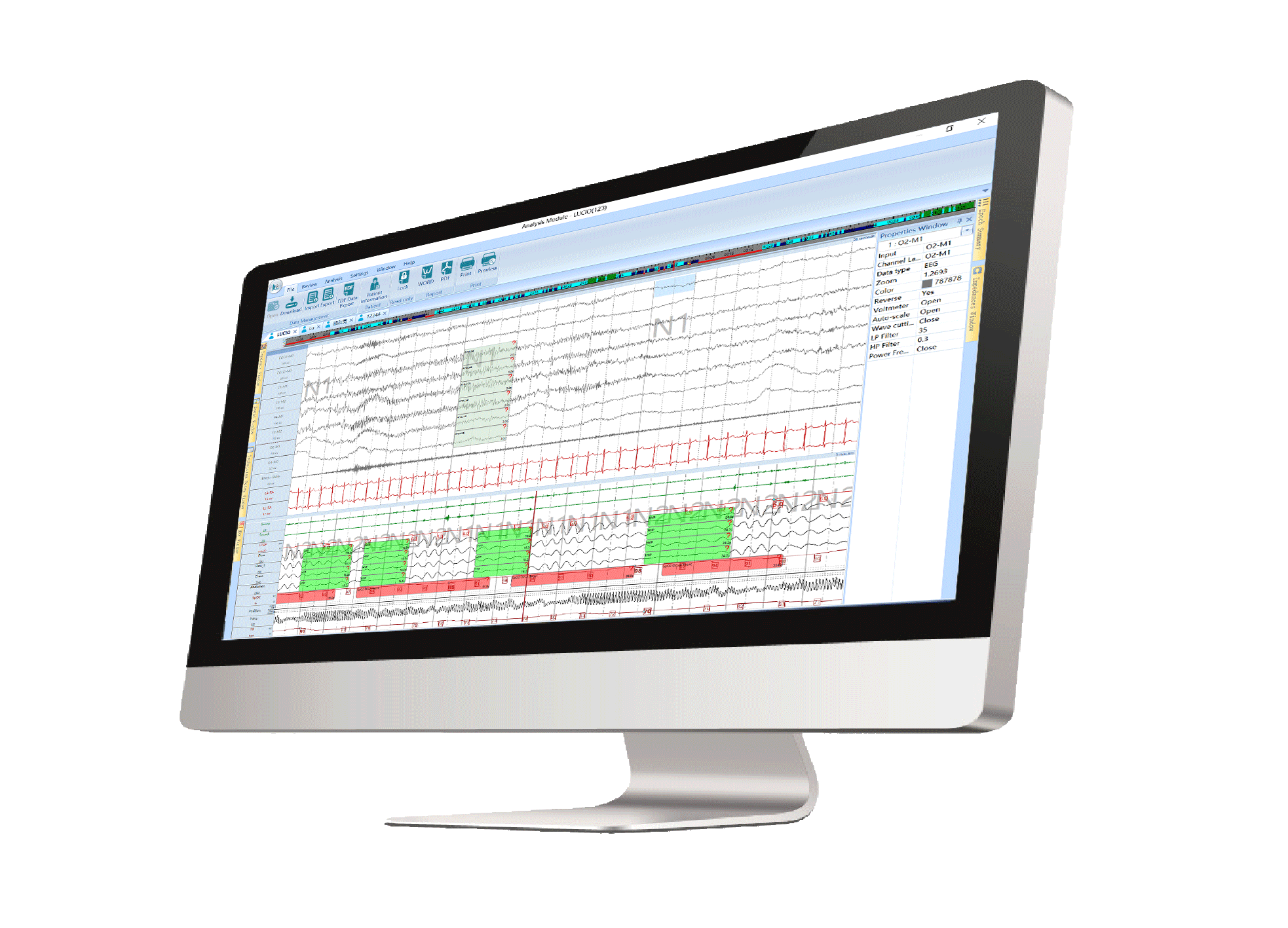 BMC怡和(hé)嘉業(yè)H2系列多(duō)導睡(shuì)眠監測儀
